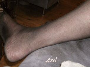 Axel