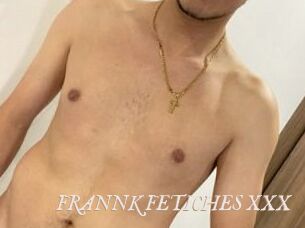 FRANNK_FETICHES_XXX