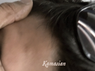 Kamasian