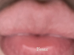 Ynnax